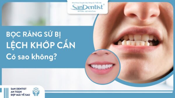 Bọc răng sứ bị lệch khớp cắn