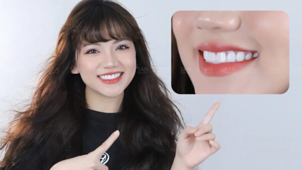 Làm răng sứ ở đâu tốt nhất TPHCM, bọc răng sứ tphcm