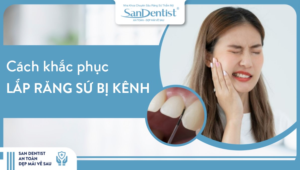 Lắp răng sứ bị kênh
