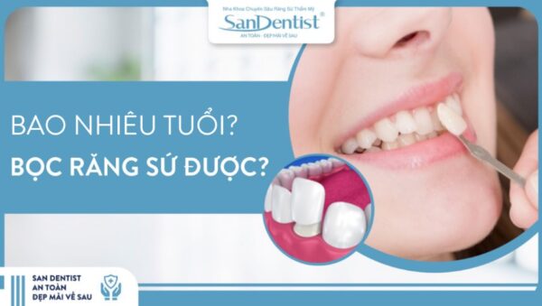Bao nhiêu tuổi thì bọc răng sứ được