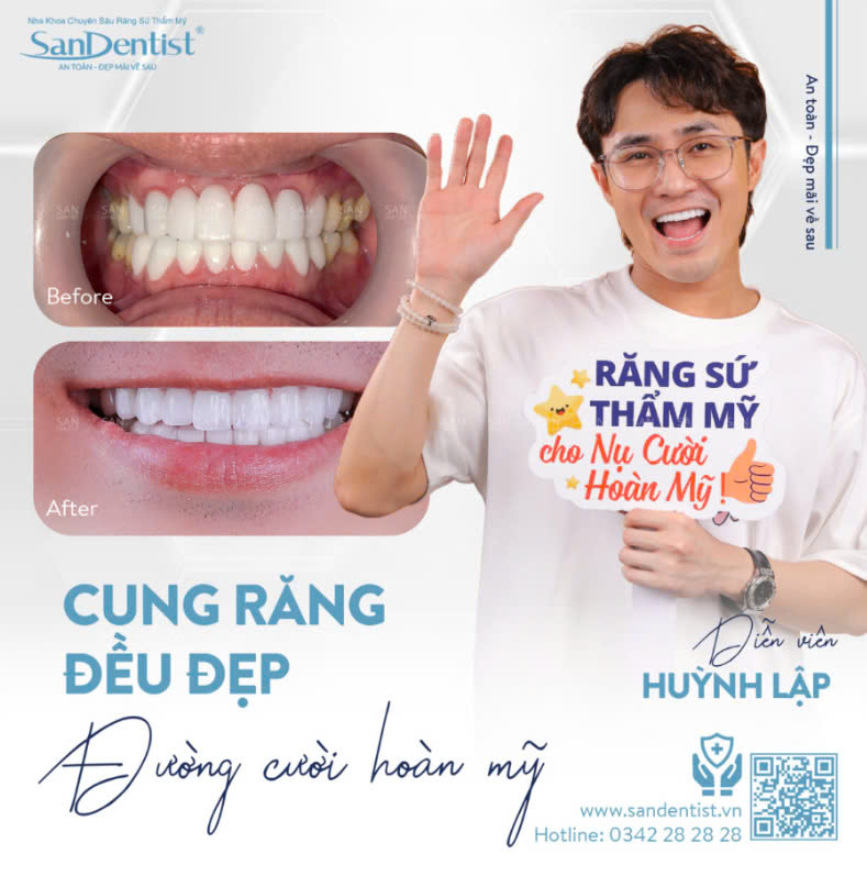 Khách hàng bọc răng sứ San Dentist