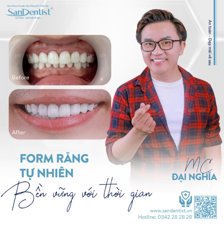 Khách hàng bọc răng sứ San Dentist