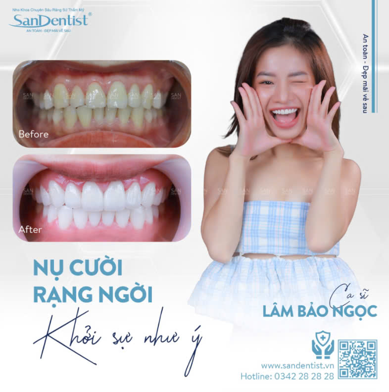 Khách hàng bọc răng sứ San Dentist