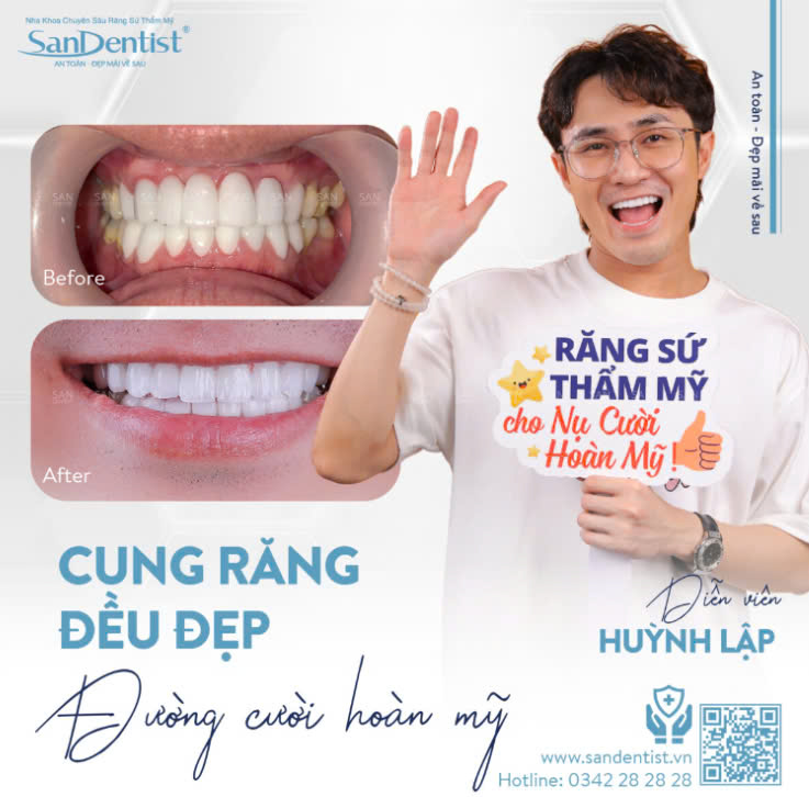Khách hàng bọc răng sứ tại San Dentist