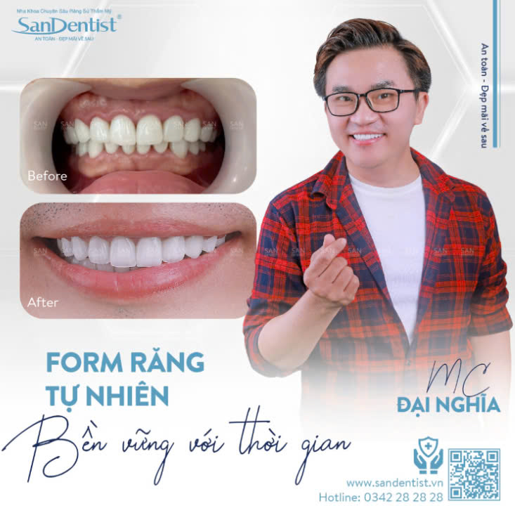 Khách hàng bọc răng sứ tại San Dentist