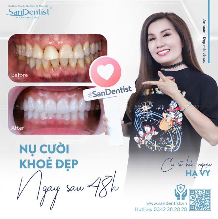 Khách hàng bọc răng sứ tại San Dentist