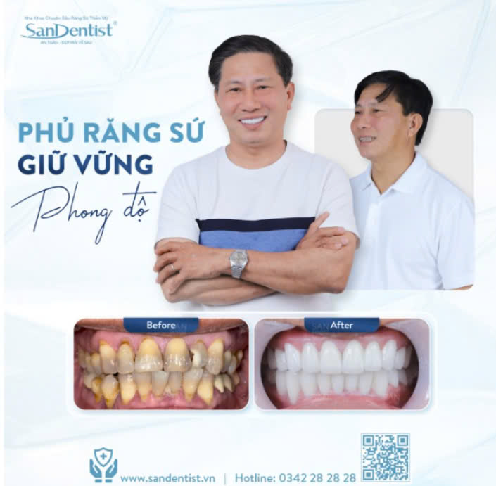 Khách hàng bọc răng sứ tại nha khoa San Dentist