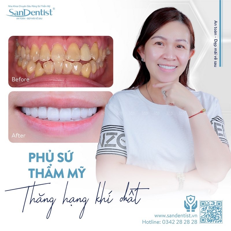Khách hàng tại Nha khoa San Dentist