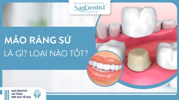 Mão răng sứ