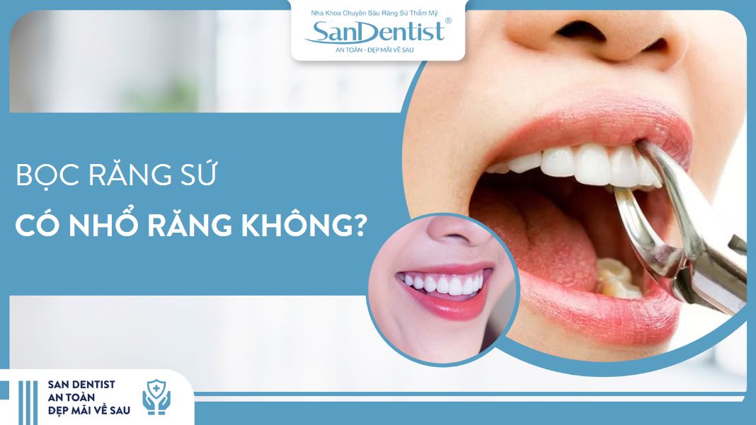 bọc răng sứ có phải nhổ răng không