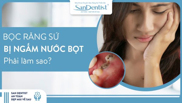 Răng Sứ Bị Ngấm Nước Bọt: Hướng Dẫn Khắc Phục Nhanh Chóng