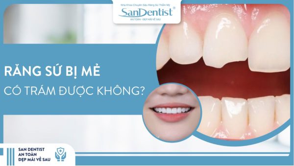 răng sứ bị mẻ có trám được không