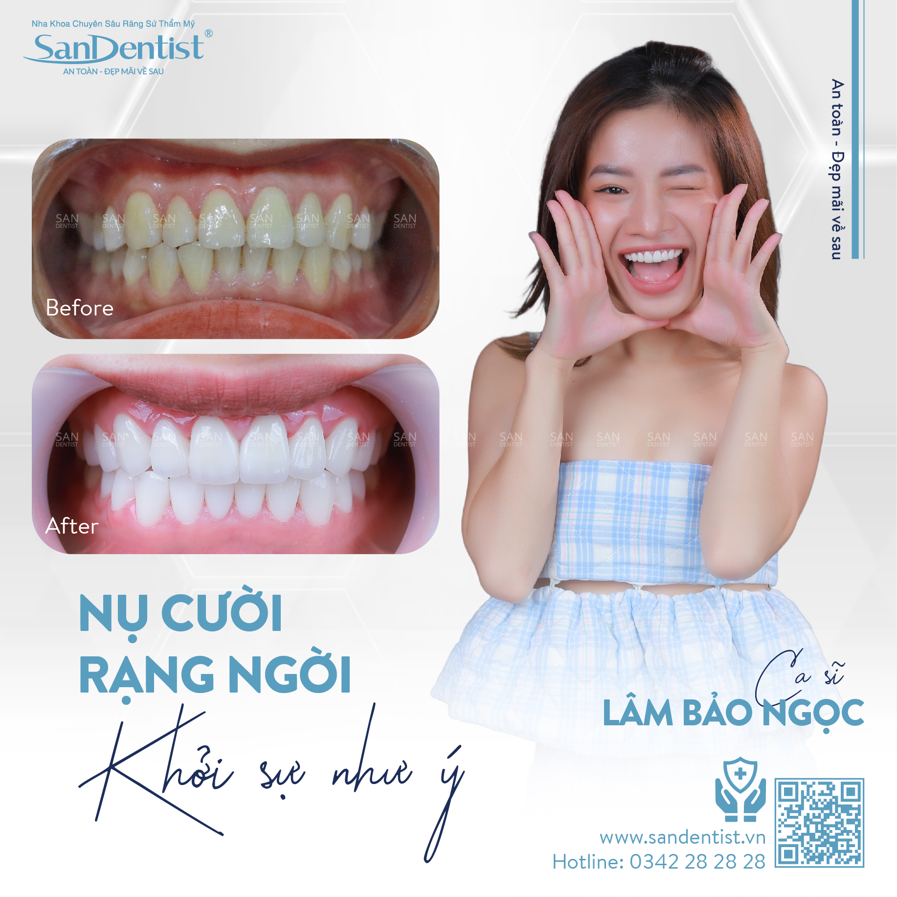Ca sĩ Lâm Bảo Ngọc – khách hàng San Dentist