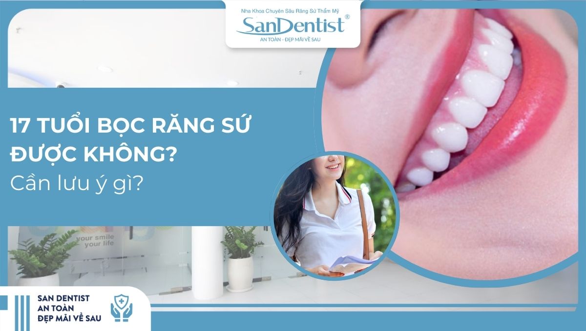 Tìm hiểu 17 tuổi bọc răng sứ được không?