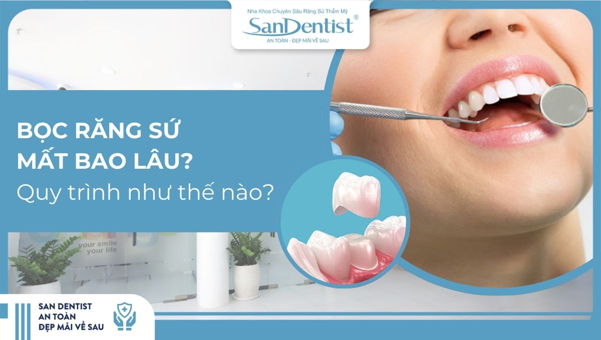 Bọc răng sứ mất bao lâu? Quy trình diễn ra như thế nào?