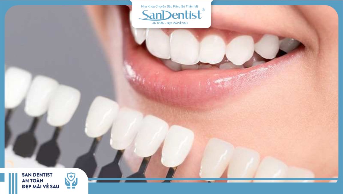 Răng sứ sinh học có ưu điểm nhìn như răng thật