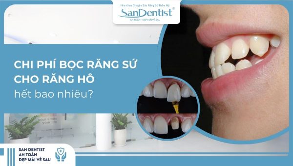 Chi phí bọc răng sứ cho răng hô hết bao nhiêu?