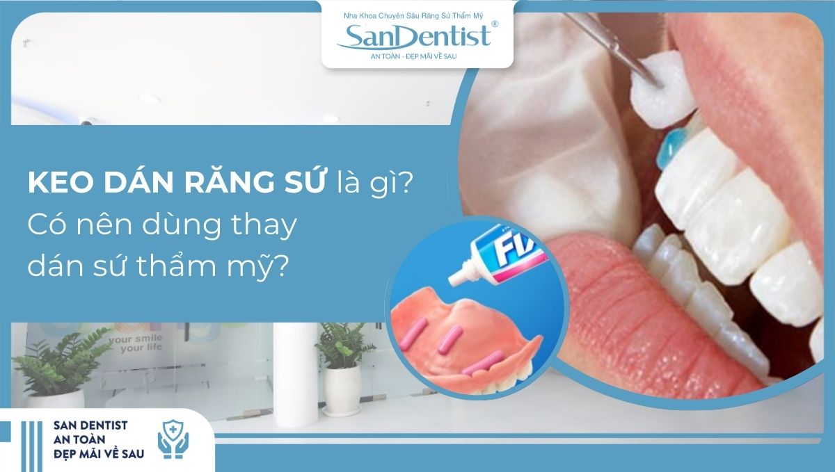 Tìm hiểu tất tần tật về keo dán răng sứ