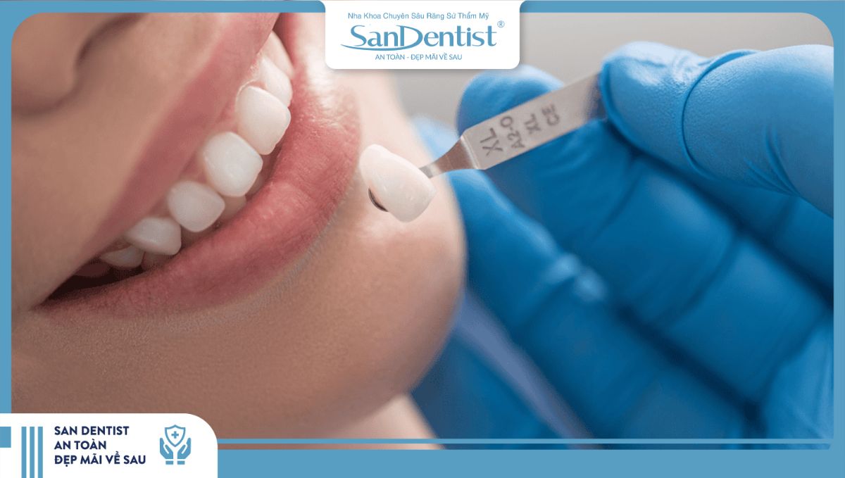 Giá niêm yết trên 1 răng sứ Orodent dao động từ 12.000.000 – 14.000.000 VNĐ
