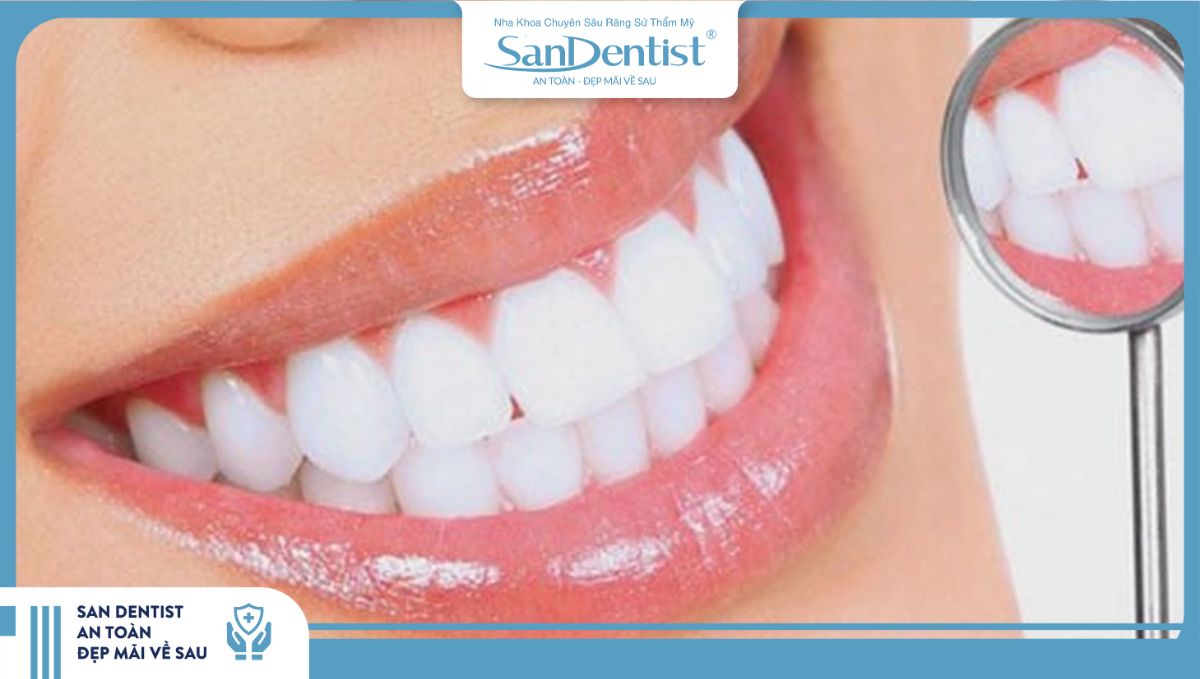 Sau khoảng 1 - 2 ngày bọc sứ là có thể ăn được gần như bình thường