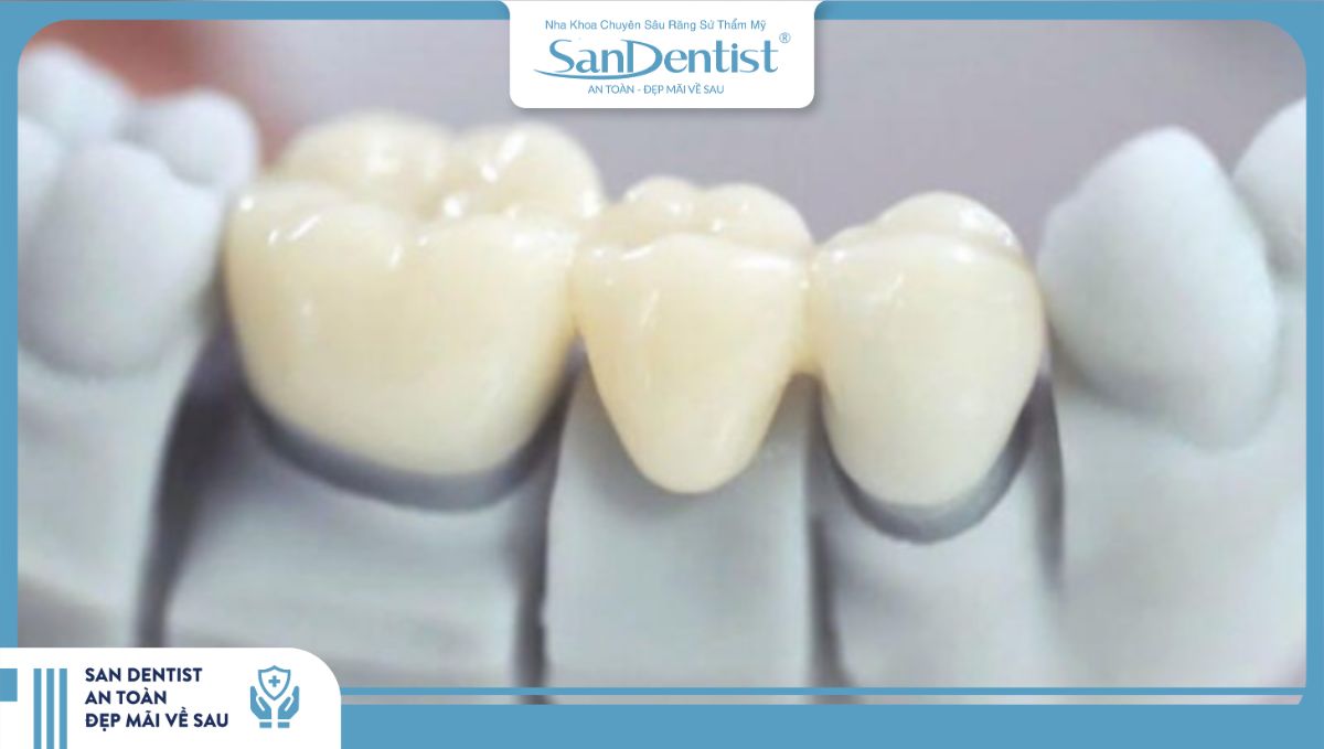 Sử dụng thực phẩm chứa các phẩm màu có thể làm răng bị xỉn màu nhanh hơn