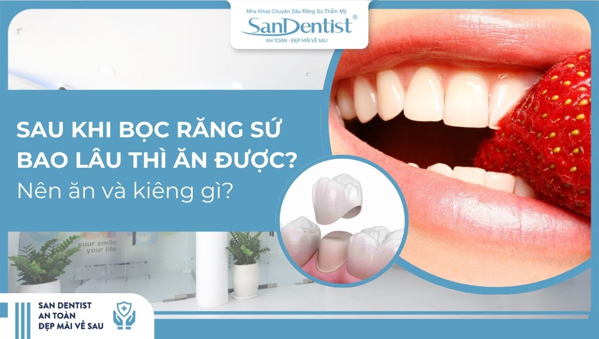 Sau khi bọc răng sứ bao lâu thì ăn được?