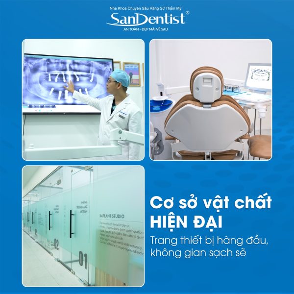 Cơ sở vật chất hiện đại San Dentist - CT Cone Beam 3D, ghế nha cao cấp, phòng trồng răng riêng tư