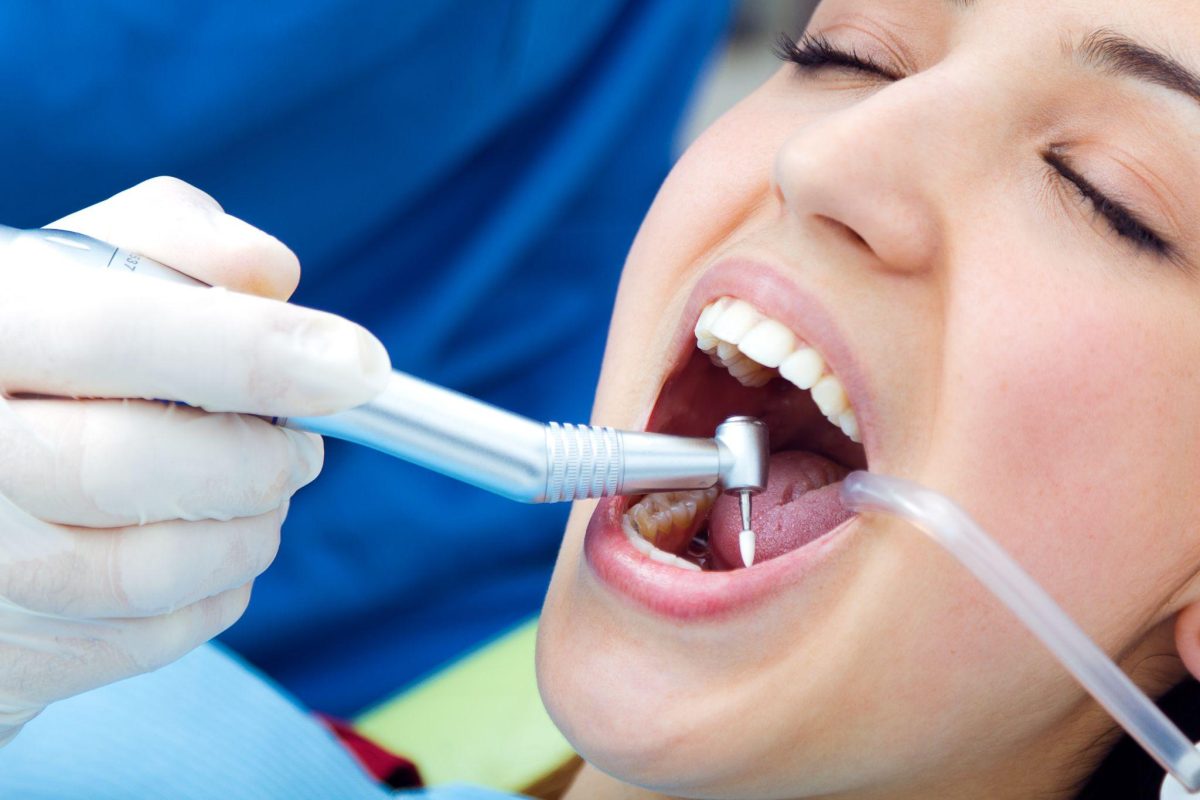 Điều trị tủy răng: Quy trình 6 bước chuẩn y khoa tại San Dentist