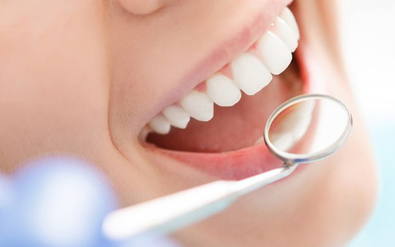 Bác sĩ khám răng định kỳ cho bệnh nhân tại San Dentist