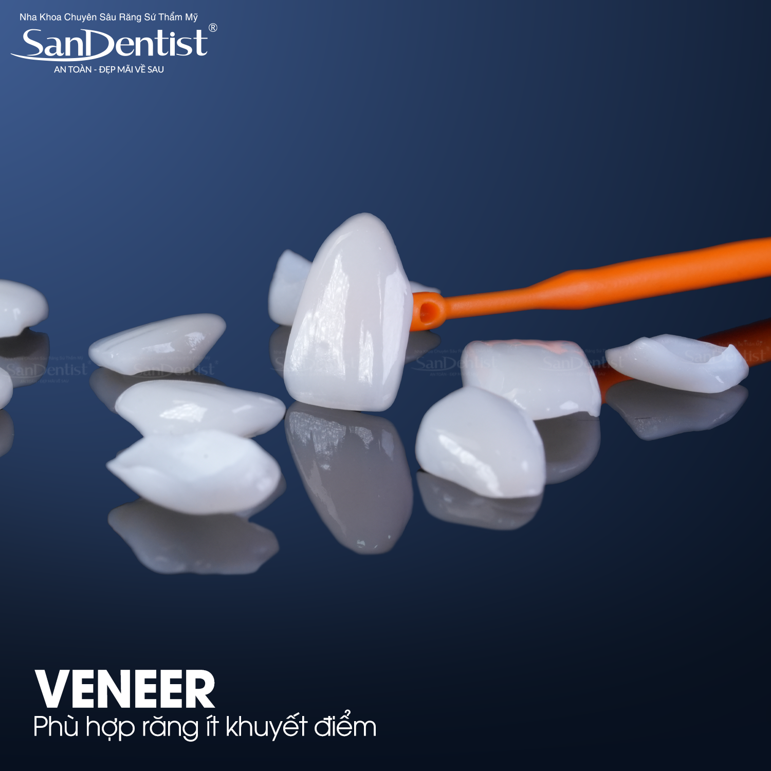 dán sứ veneer không mài - hình 3