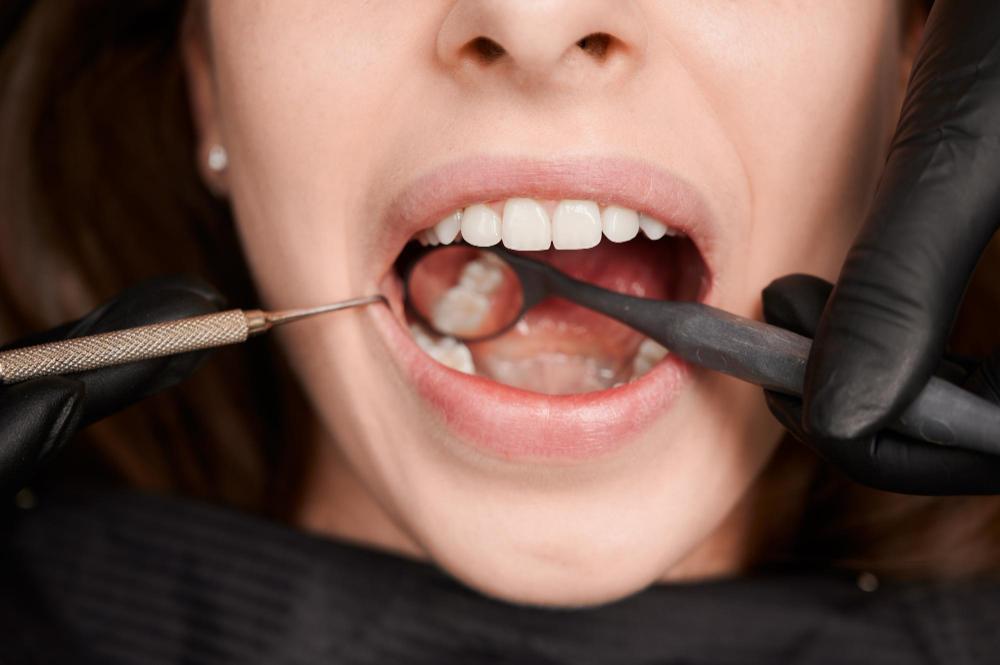 điều trị tủy răng tphcm - hình 4
