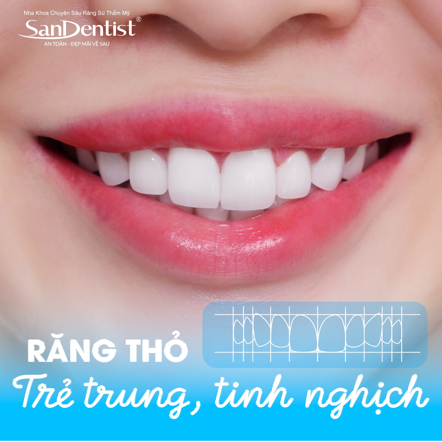Răng thỏ – Trẻ trung, tinh nghịch