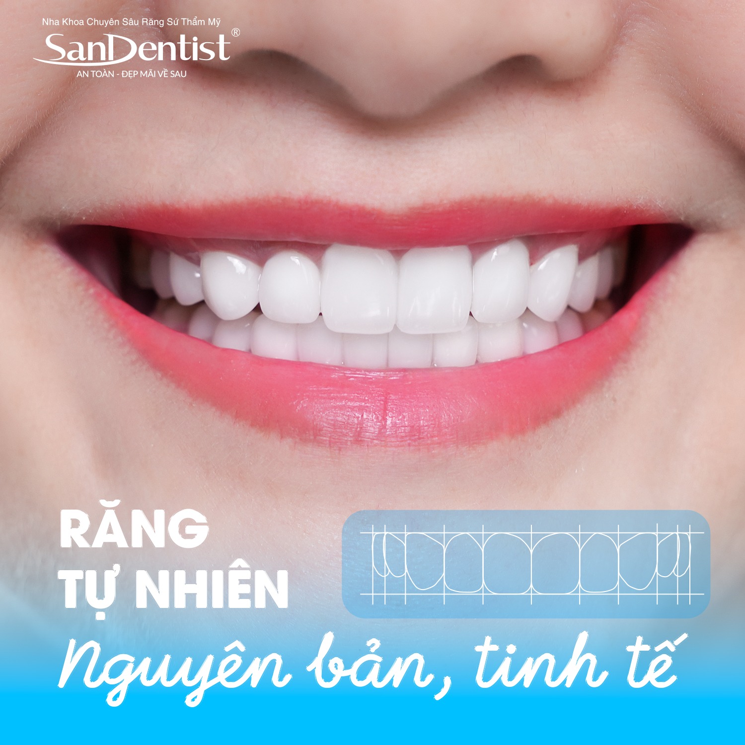 Răng tự nhiên – Nguyên bản, tinh tế