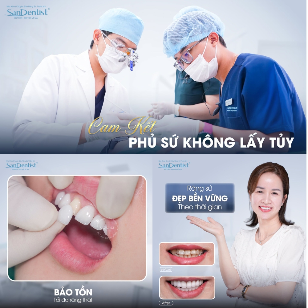 combo 16 răng sứ orodent