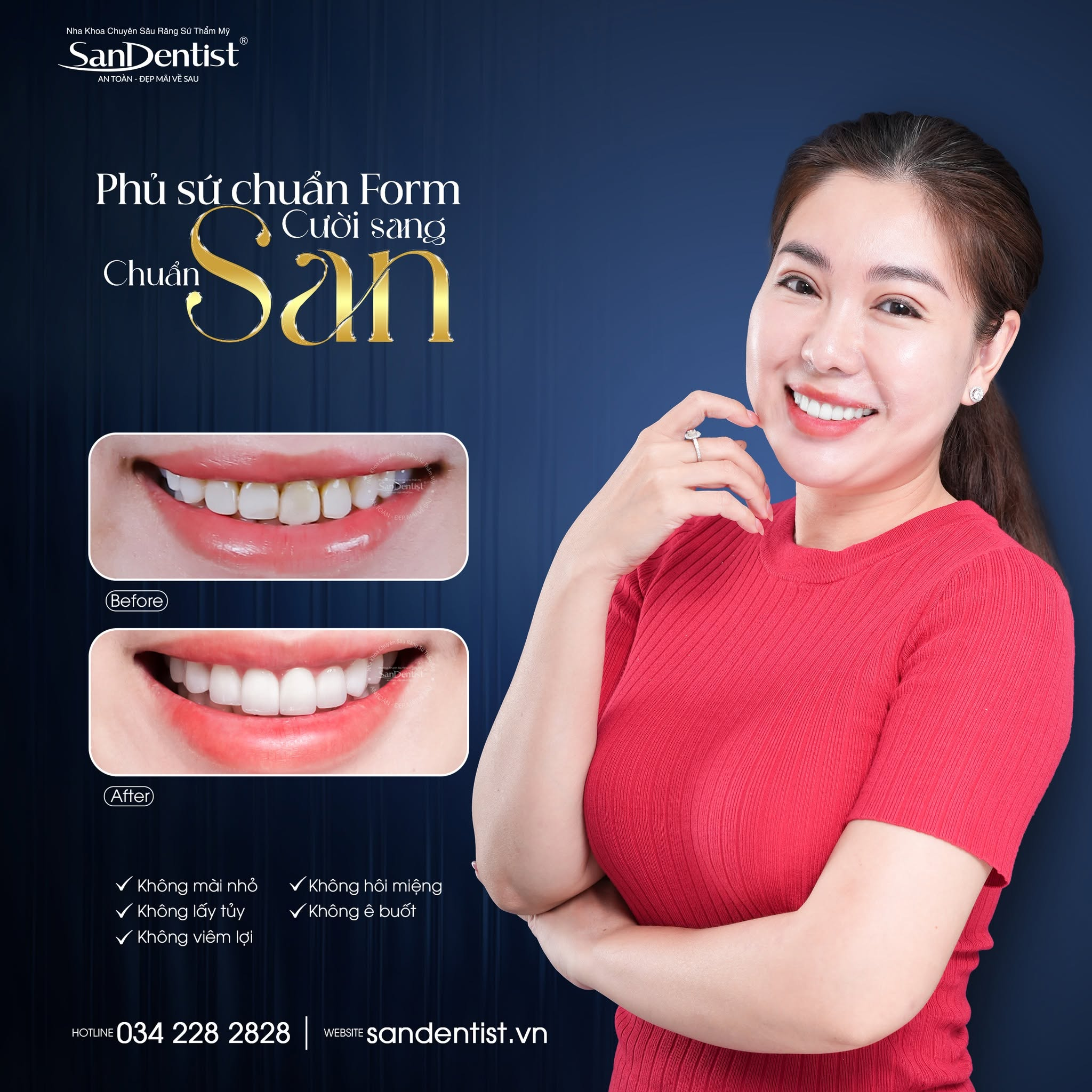 combo 16 răng sứ orodent - hình 2