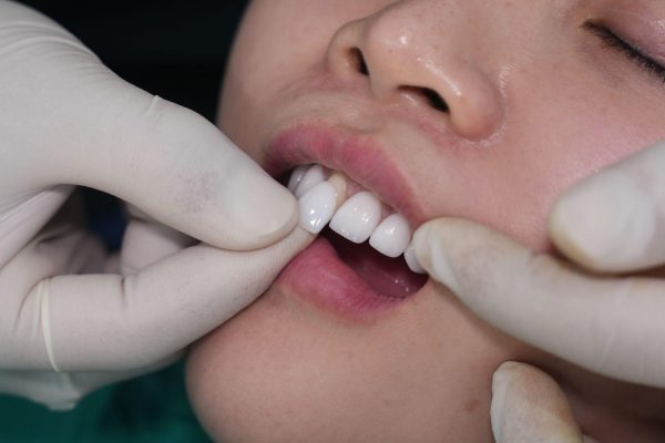 Nha khoa San Dentist “gieo nụ cười hôm nay, vun đắp tương lai mai sau”