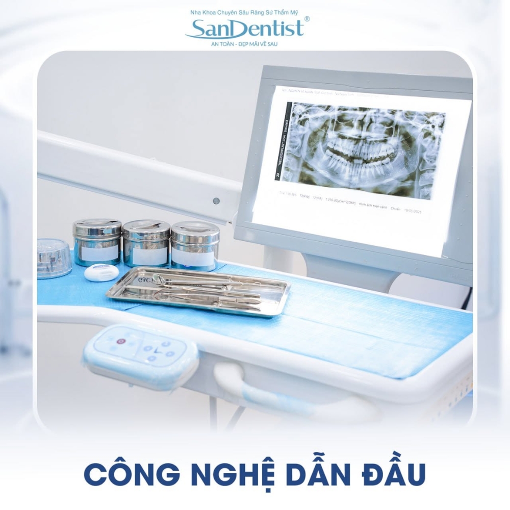 dán veneer không mài tphcm - hình 4