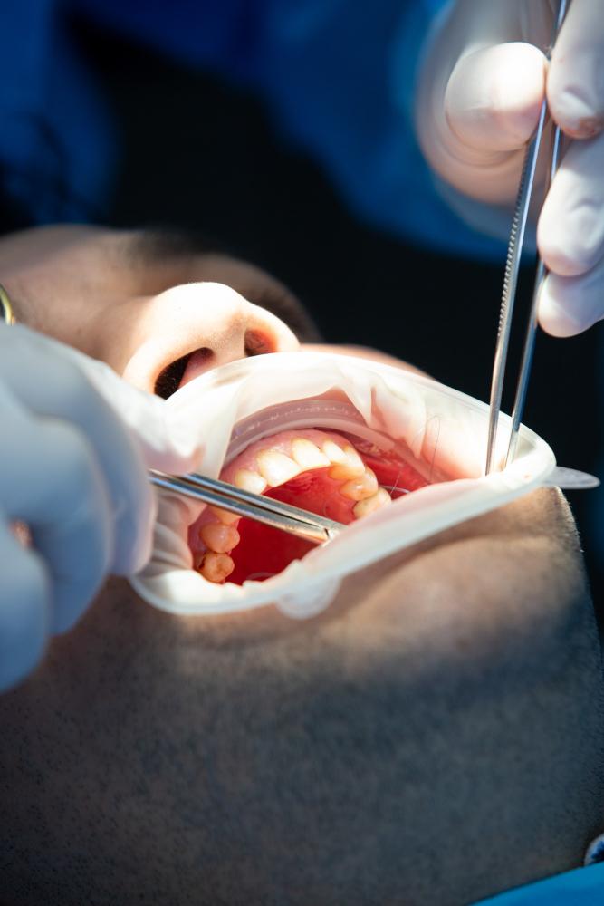 hồi phục sau lấy tủy - hình 4