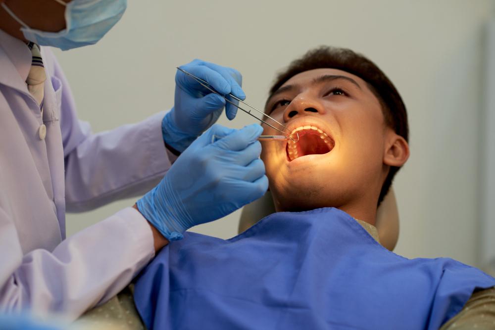 lấy cao răng có tốt - hình 2