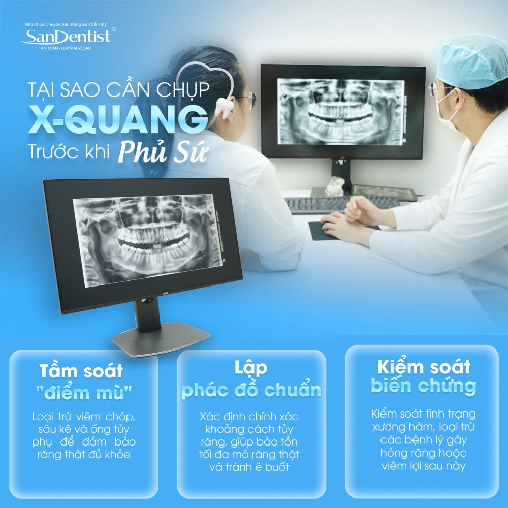 quy trình bọc răng sứ - hình 2