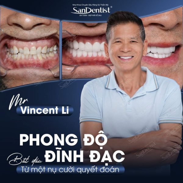 Răng sứ Emax Zircad Mỹ: chất lượng & giá 2026