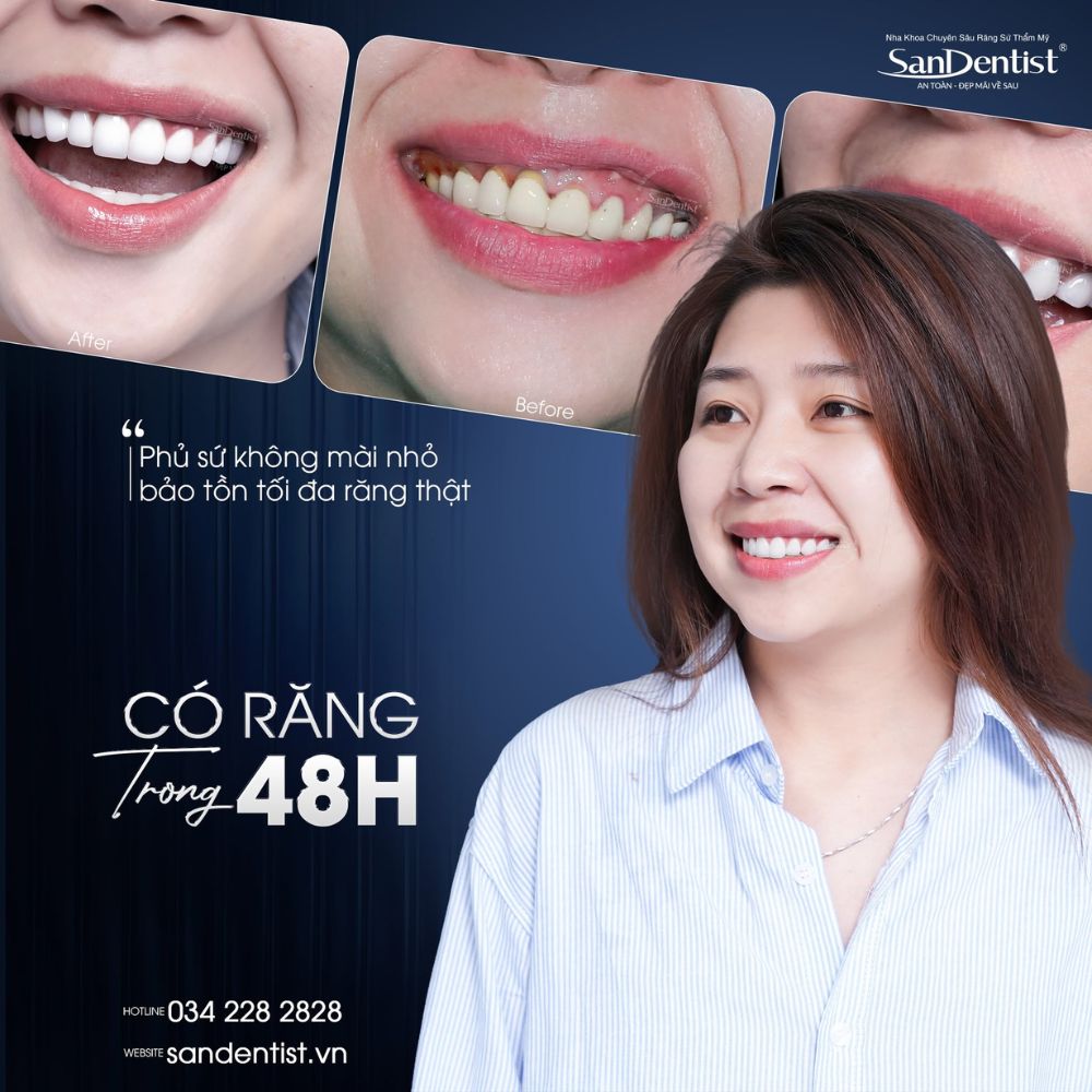 răng sứ emax zircad - hình 2