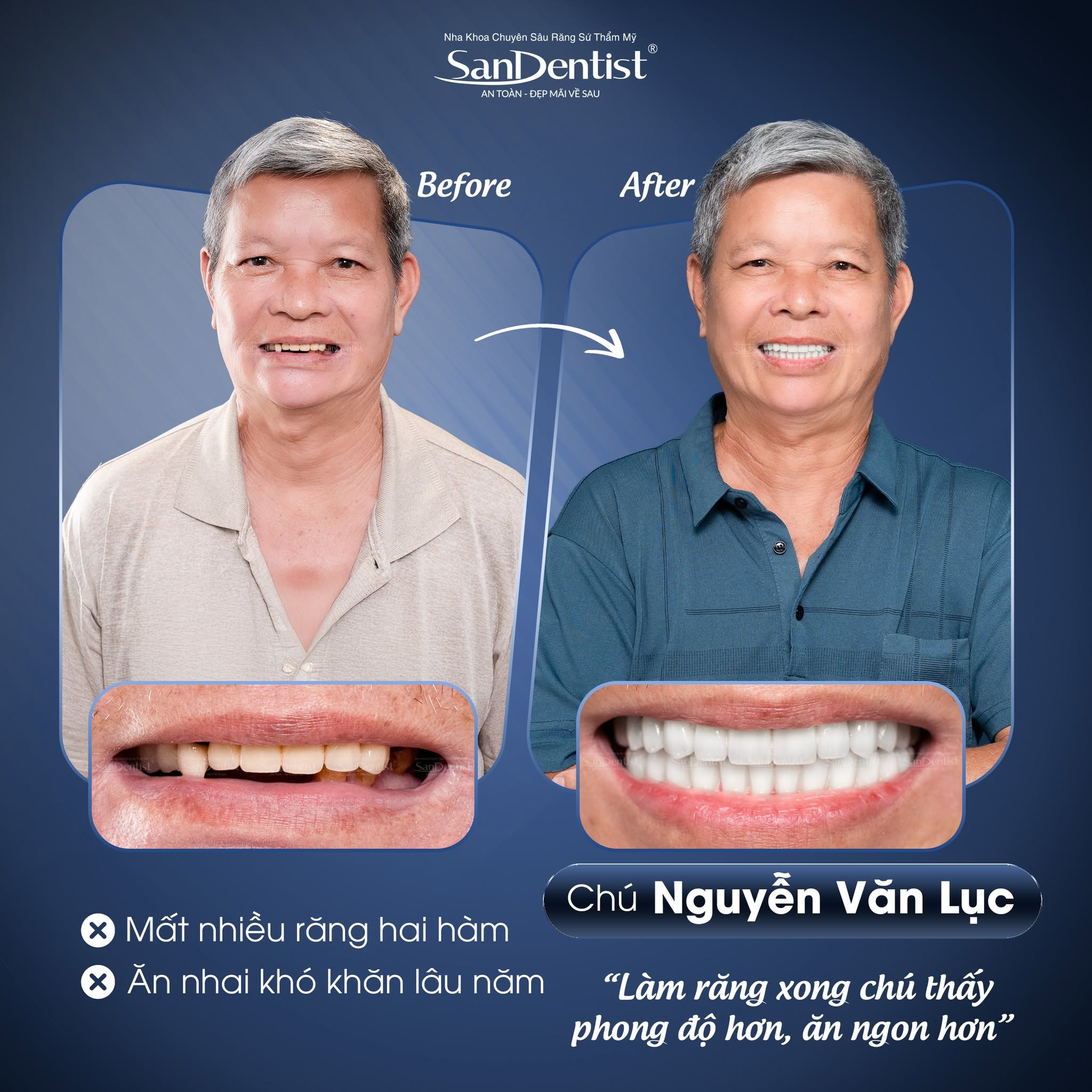chăm sóc răng người già
