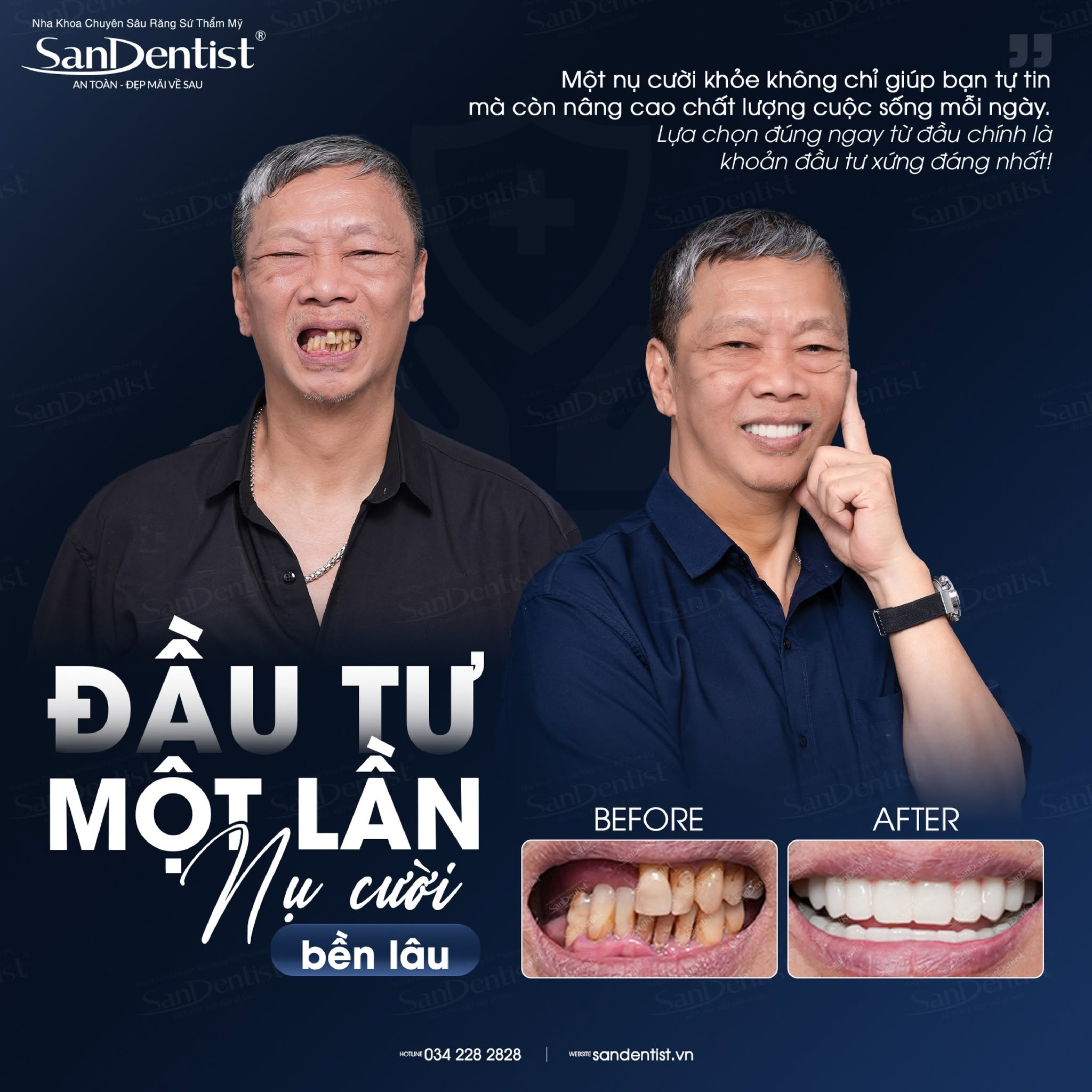 chăm sóc răng người già - hình 3