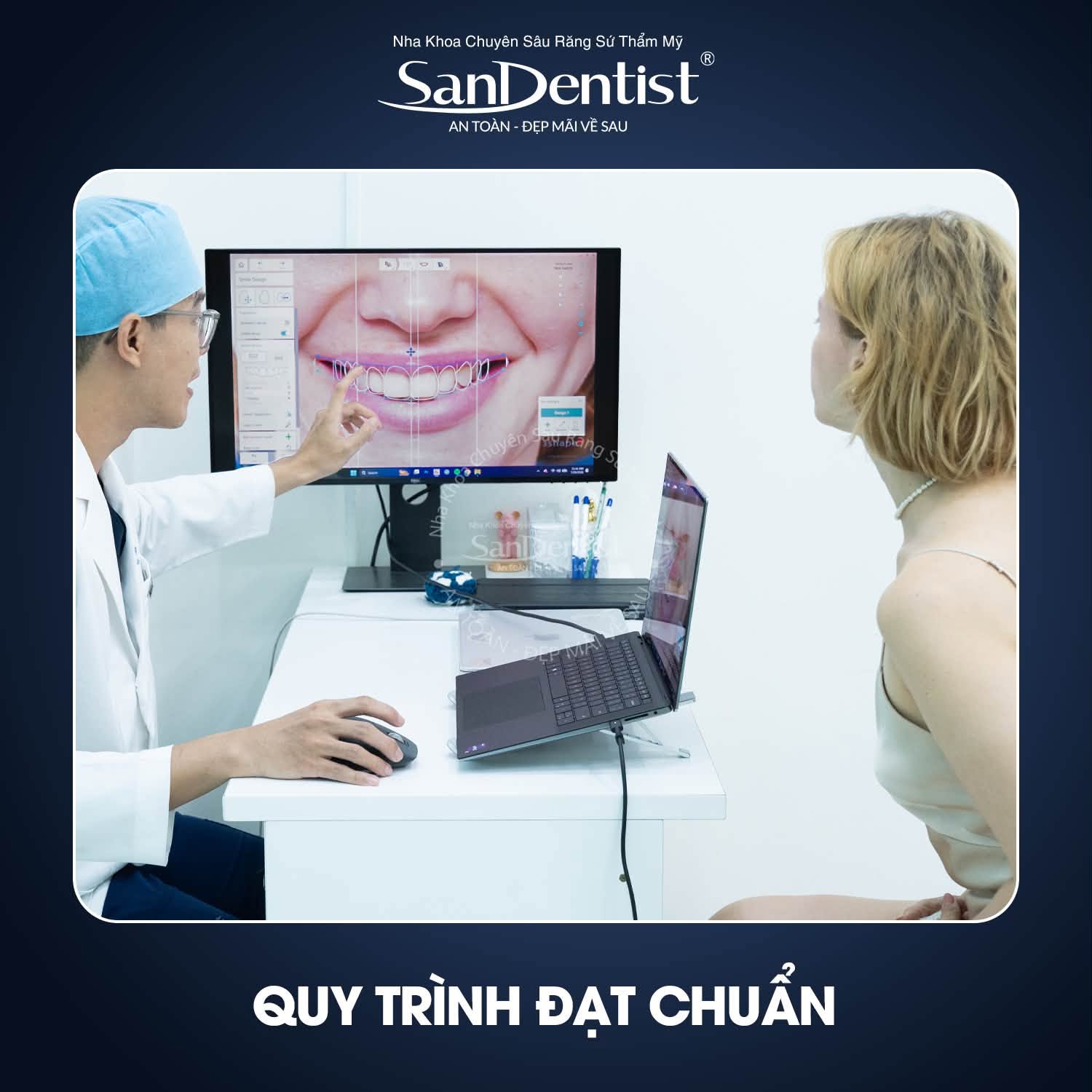 nhổ răng cối nhỏ niềng