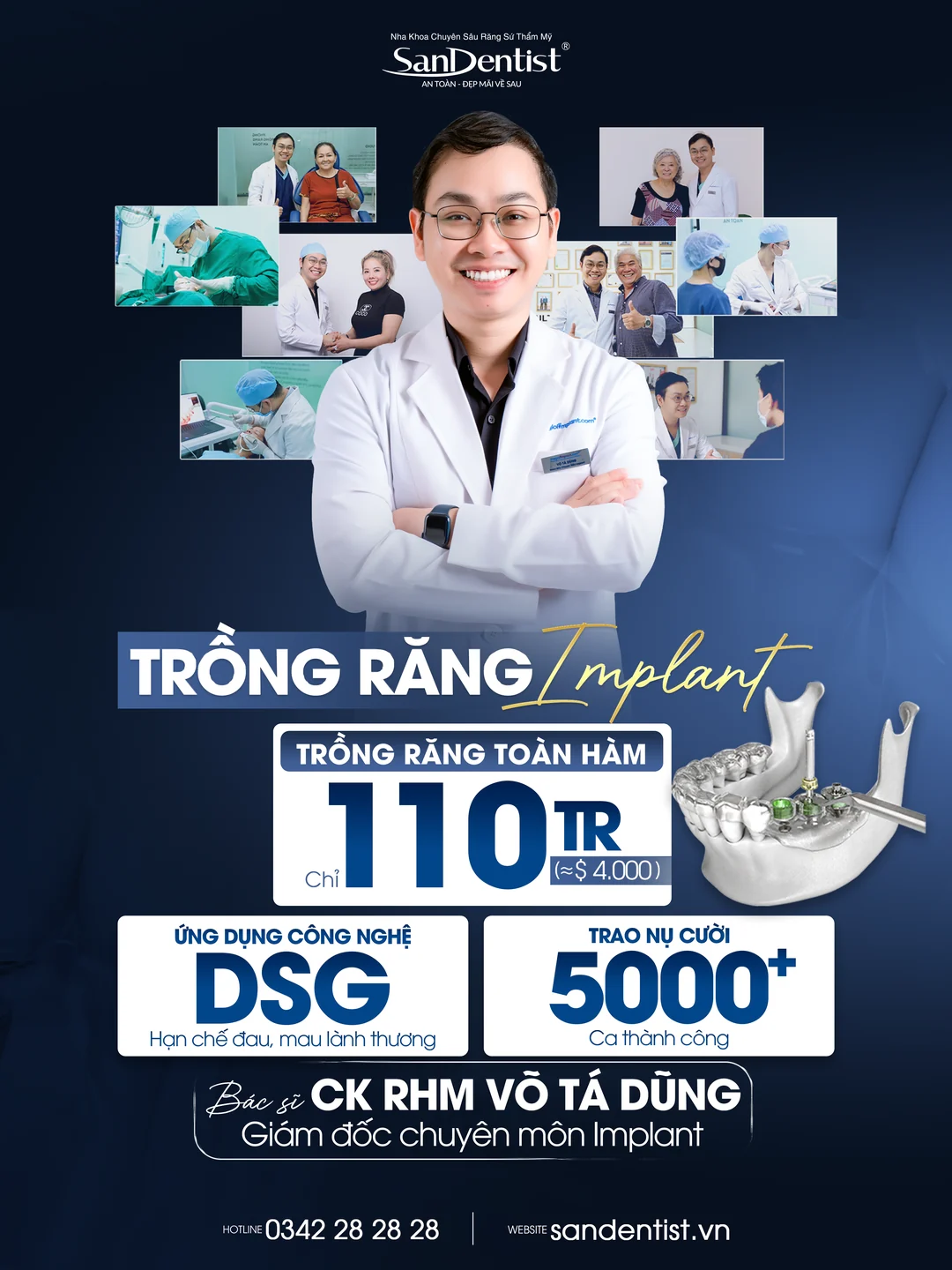 Trồng răng Implant toàn hàm chỉ 110 triệu tại San Dentist