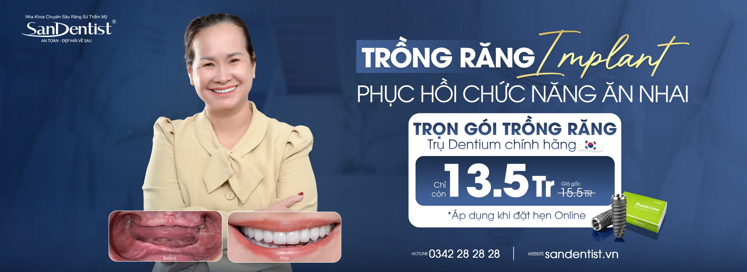 Trọn gói trồng răng Implant trụ Dentium chính hãng tại San Dentist