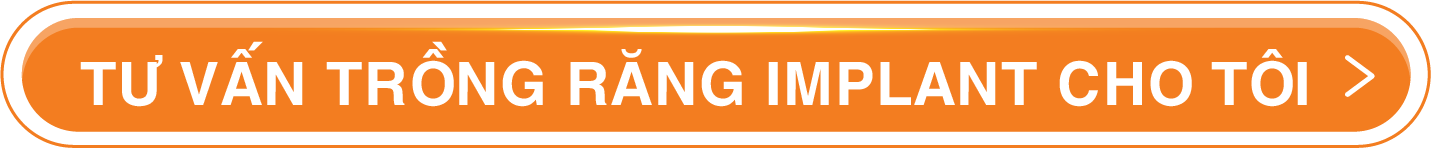 Tư vấn trồng răng Implant cho tôi