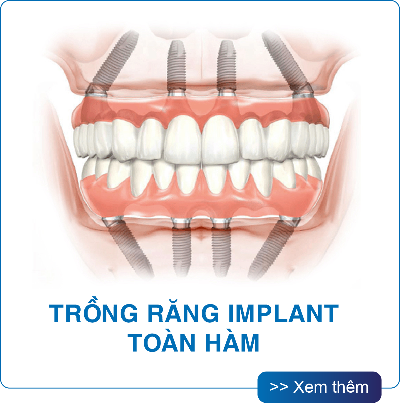 San Dentist Homepage v1