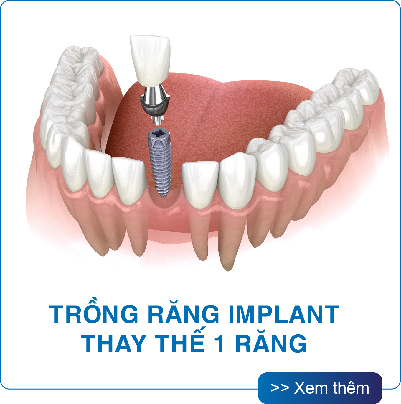 San Dentist Homepage v1